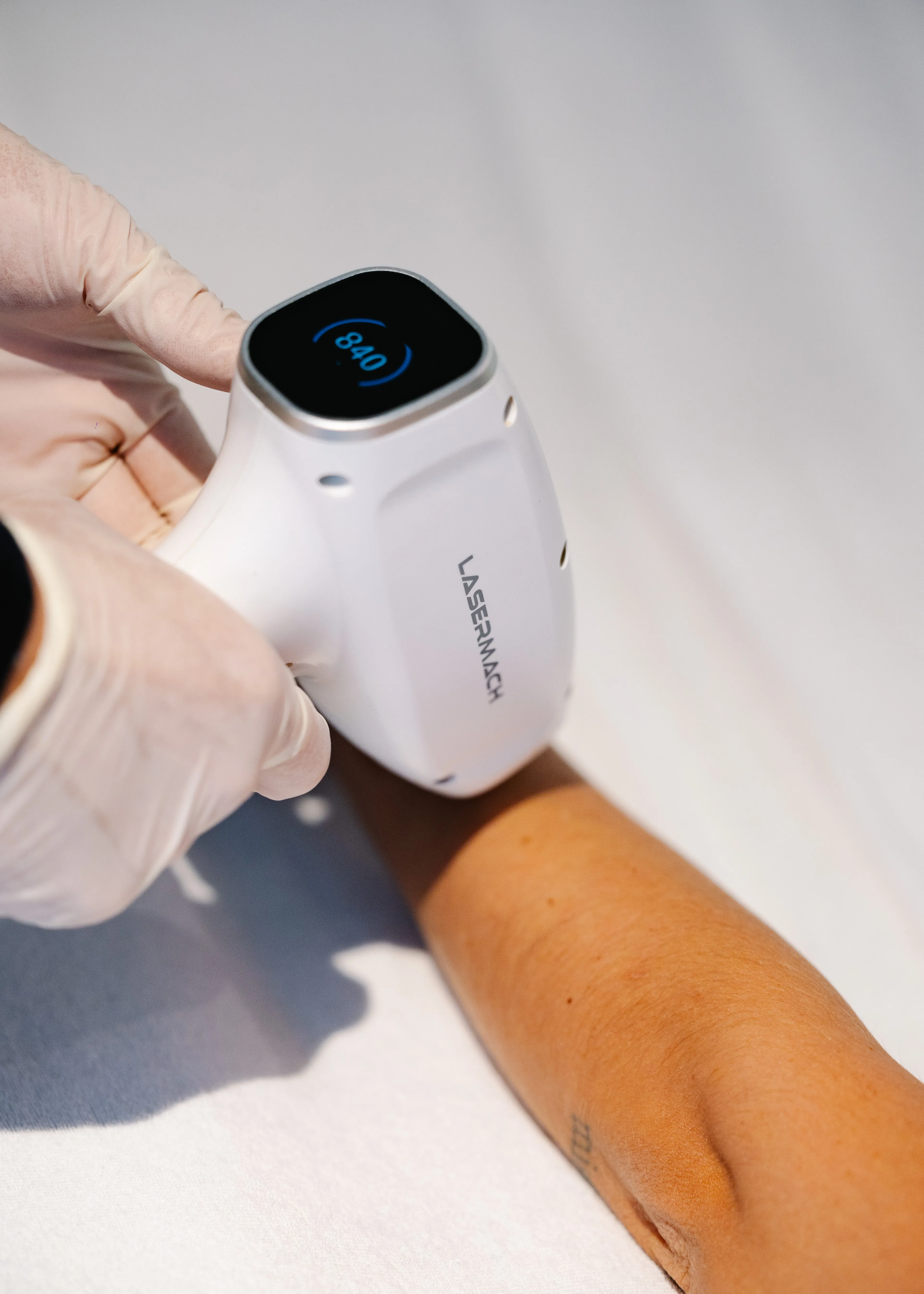 Épilation laser diode –